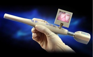 Wireless Intraoralkamera 
