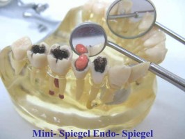 12 x Endo Spiegel Zahnspiegel Mundspiegel
